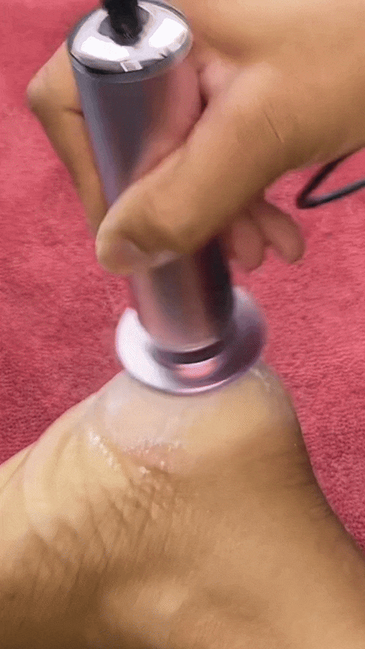 Electric Foot Callous Remover